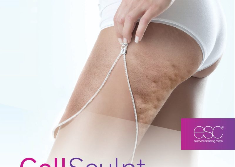 European Slimming Centre Hadirkan Cells Sculpt, Inovasi Perawatan Kecantikan Hilangkan Selulit Tanpa Rasa Sakit