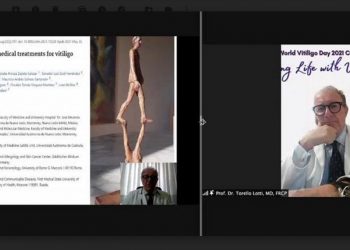 Mengenal Seluk-Beluk Masalah Kesehatan Mental yang Dialami Pasien Vitiligo