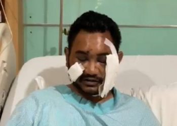 Polda DIY Janji Selesaikan Kasus Penganiayaan Dengan Adil