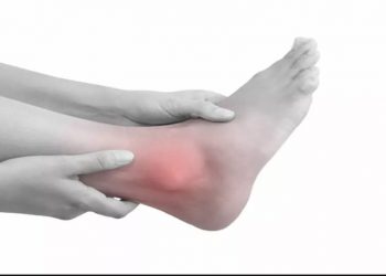 Segini Kadar Asam Urat Normal Wanita dan Pria