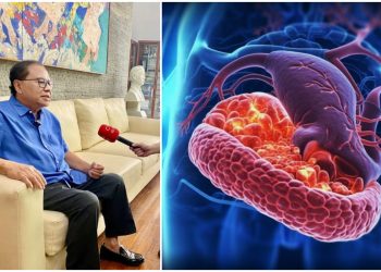 Diidap Mendiang Rizal Ramli, Ternyata ini Tingkat Keganasan Kanker Pankreas dan Implikasinya pada Kesehatan