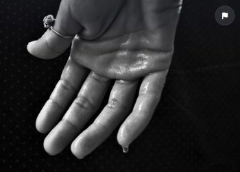 Begini Cara Mengatasi Keringat Berlebihan, Lakukan ini