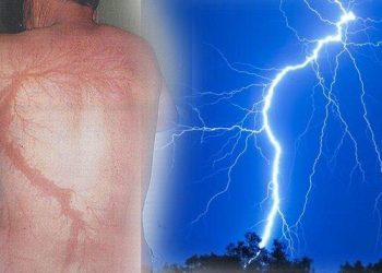 Pria di Subang Tewas Saat Bermain Bola, Ternyata ini Bahaya Tersambar Petir