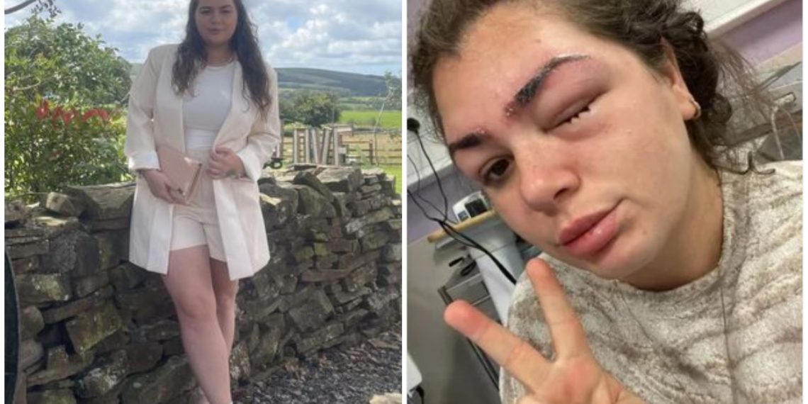 Horor! Wanita Cantik ini Terancam Buta Gara-gara Tergiur Sulam Alis di Klinik Kecantikan