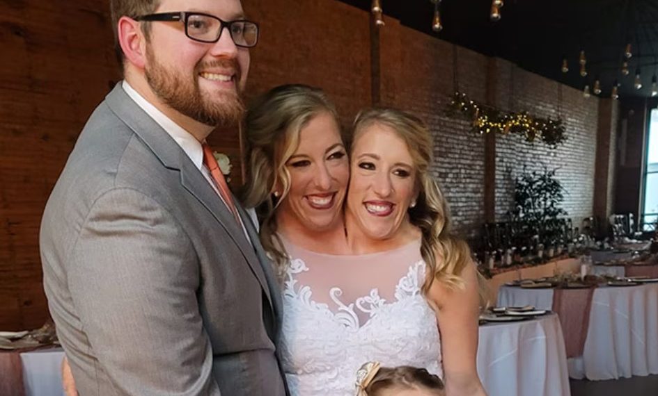 Usai Dua Tahun Dirahasiakan, Akhirnya Pernikahan Kembar Siam Abby Hensel dan Brittany Terbongkar Juga