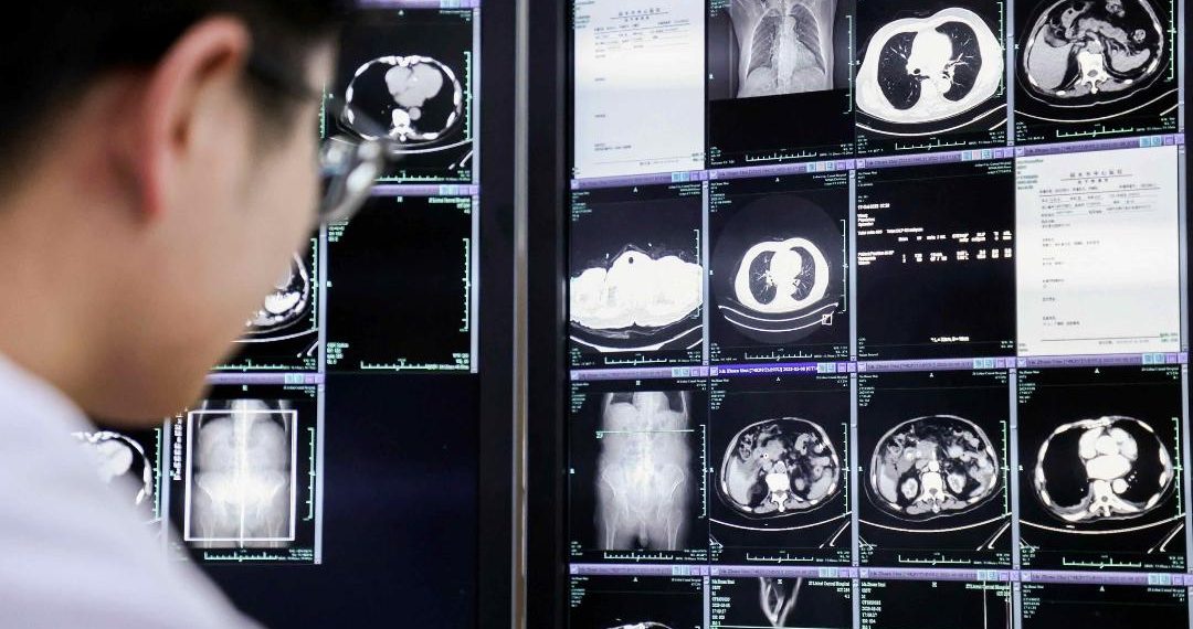 DAMO Academy Bekerjasama dengan Pusat Kolaborasi World Health Organization untuk Kesehatan Digital Guna Memajukan AI Dalam Dunia Medis